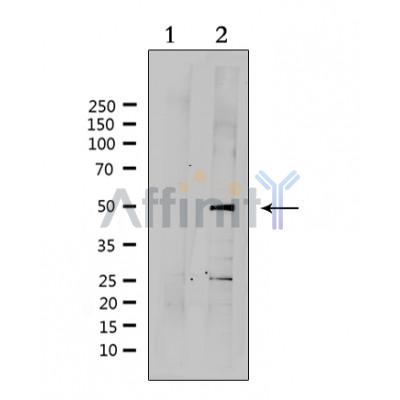 SUV39H2 Antibody - Western blot analysis of extracts from HepG2, using SUV39H2 Antibody.