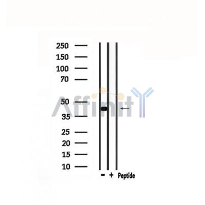 POU4F1 Antibody - Western blot analysis of extracts from mouse brain, using POU4F1 Antibody.