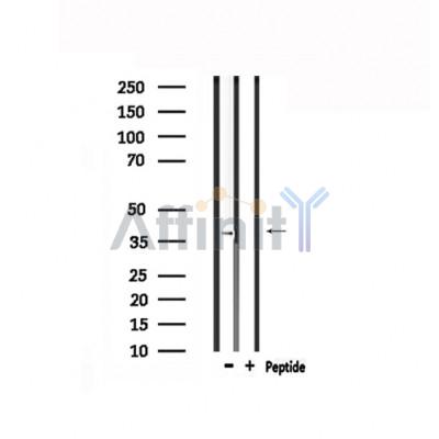 GPR175 Antibody - Western blot analysis of extracts from HepG2, using GPR175 Antibody.