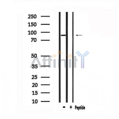 GPR133 Antibody - Western blot analysis of extracts from mouse lung, using GPR133 Antibody.