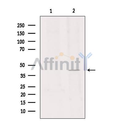 GPR34 Antibody - Western blot analysis of extracts from rat brain, using GPR34 Antibody.