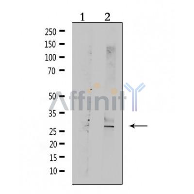 TNFRSF10C Antibody - Western blot analysis of extracts from rat muscle, using TNFRSF10C  Antibody.