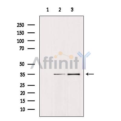 EpCAM Antibody - Western blot analysis of extracts from various samples, using TACSTD1  Antibody.