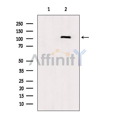 TLR8 Antibody - Western blot analysis of extracts from rat brain, using TLR8  Antibody.