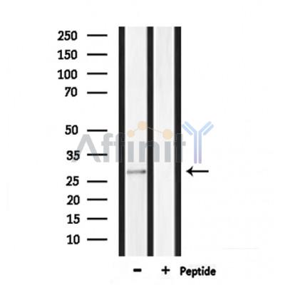 MPZ Antibody - Western blot analysis of extracts from rat muscle, using MPZ Antibody.