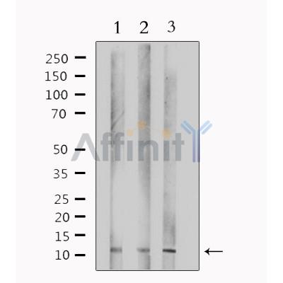TUSC2 Antibody - Western blot analysis of extracts from various samples, using TUSC2 Antibody.