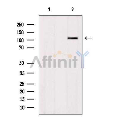 ZNF295 Antibody - Western blot analysis of extracts from HepG2, using ZNF295 Antibody.