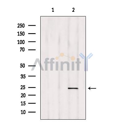 RAB35 Antibody - Western blot analysis of extracts from HepG2, using RAB35 Antibody.
