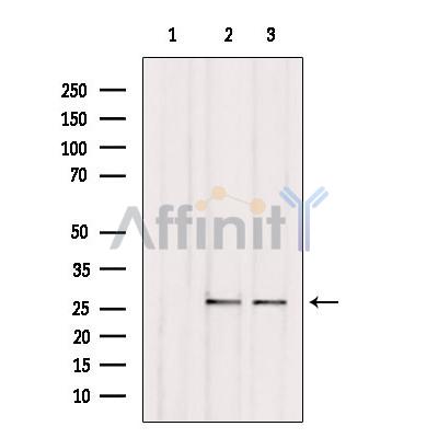 C1QL3 Antibody - Western blot analysis of extracts from various samples, using C1QL3 Antibody.