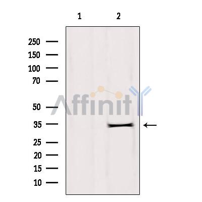 DHRS1 Antibody - Western blot analysis of extracts from rat brain, using DHRS1 Antibody.