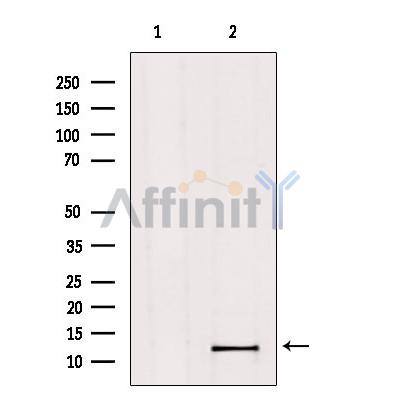 MED11 Antibody - Western blot analysis of extracts from Hela, using MED11 Antibody.
