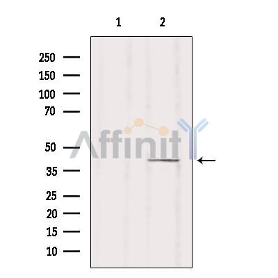 ZDHHC18 Antibody - Western blot analysis of extracts from HUVEC, using ZDHHC18 Antibody.