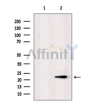 PPP1R2P3 Antibody - Western blot analysis of extracts from mouse lung, using PPP1R2P3 Antibody.