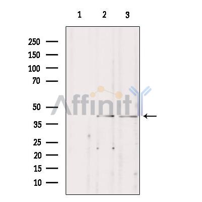 STAC3 Antibody - Western blot analysis of extracts from various samples, using STAC3 Antibody.