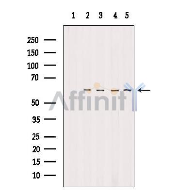 TIGD2 Antibody - Western blot analysis of extracts from various samples, using TIGD2 Antibody.