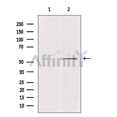 A1Up Antibody - Western blot analysis of extracts from mouse brain, using A1Up Antibody.