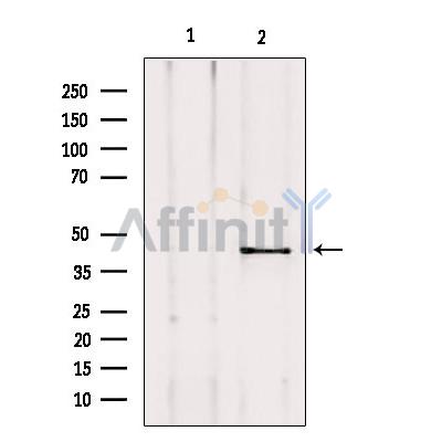 AKAP5 Antibody - Western blot analysis of extracts from mouse lung, using AKAP5 Antibody.