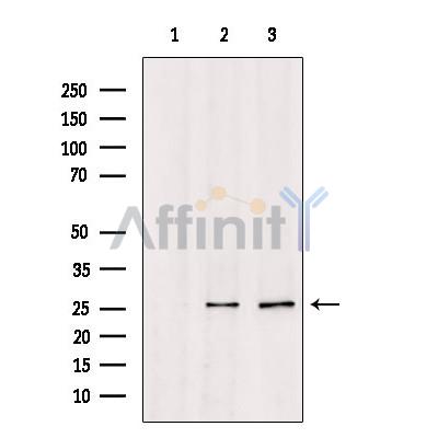TSPAN8 Antibody - Western blot analysis of extracts from various samples, using TSPAN8 Antibody.