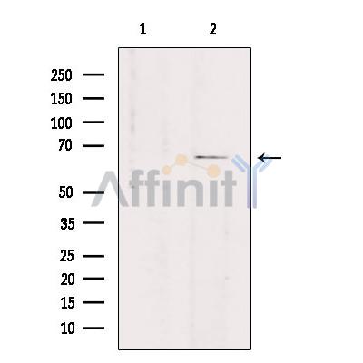 SLC7A4 Antibody - Western blot analysis of extracts from rat brain, using SLC7A4 Antibody.