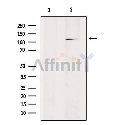 RANBP17 Antibody - Western blot analysis of extracts from HepG2, using RANBP17 Antibody.