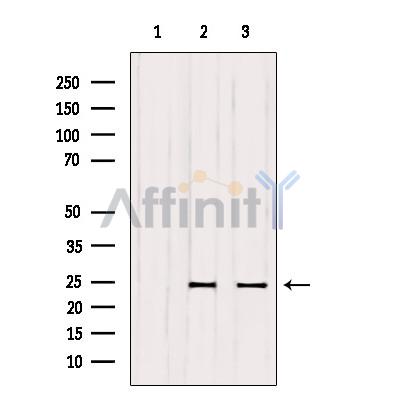 RAB6A Antibody - Western blot analysis of extracts from various samples, using RAB6A Antibody.