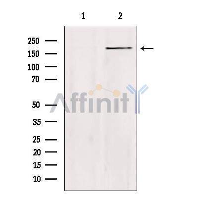 ZC3H13 Antibody - Western blot analysis of extracts from Hela, using ZC3H13 Antibody.
