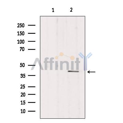 DLK1 Antibody - Western blot analysis of extracts from mouse brain, using DLK1 Antibody.