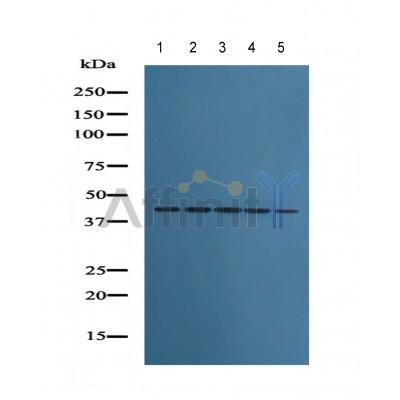 beta Actin Antibody - Western blot analysis of extracts from NIH/3T3 (1), Jurkat (2), rat brain  (3), rat liver (4), PC12 (5) lysates,using Beta-actin Antibody.