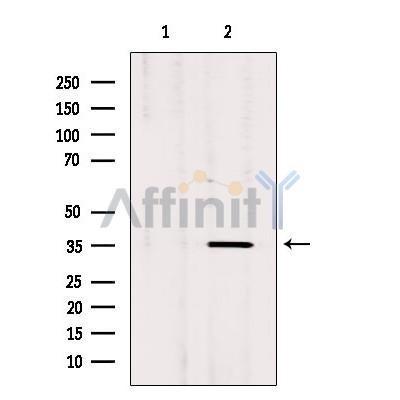 OR3A1 Antibody - Western blot analysis of extracts from rat brain, using OR3A1 Antibody.