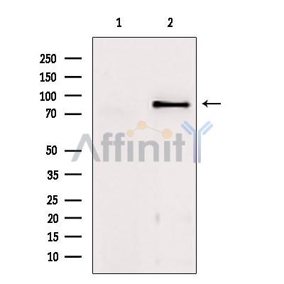 TACC1 Antibody - Western blot analysis of extracts from mouse brain, using TACC1 Antibody.