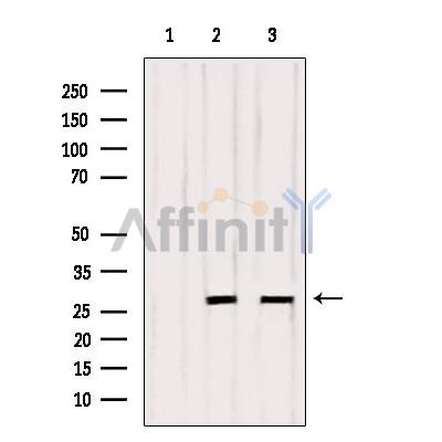 OTUB2 Antibody - Western blot analysis of extracts from various samples, using OTUB2 Antibody.
