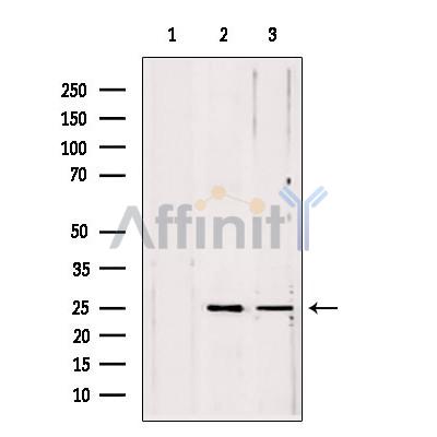 PLDN Antibody - Western blot analysis of extracts from various samples, using PLDN antibody.