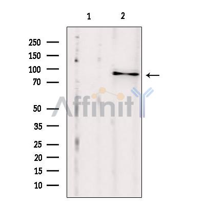SEC5/EXOC2 Antibody - Western blot analysis of extracts from HepG2, using SEC5/EXOC2 antibody.