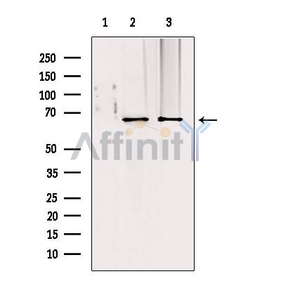 TOM70 Antibody - Western blot analysis of extracts from various samples, using TOM70 antibody.