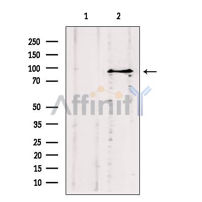 ODF2 Antibody - Western blot analysis of extracts from HepG2, using ODF2 antibody.