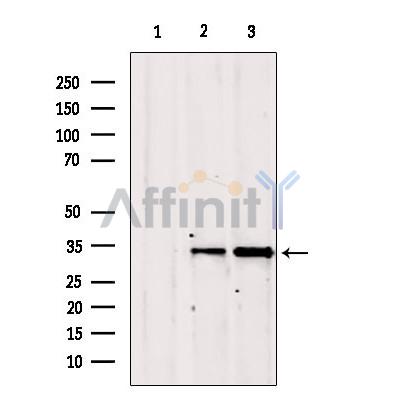 GOLPH3 Antibody - Western blot analysis of extracts from various samples, using GOLPH3 antibody.