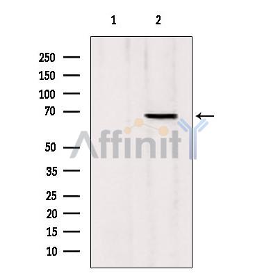 MTA3 Antibody - Western blot analysis of extracts from Mouse Myeloma cell, using MTA3 antibody.