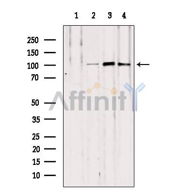 NOD2 Antibody - Western blot analysis of extracts from various samples, using NOD2 antibody.