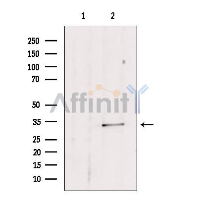 Estrogen Sulfotransferase Antibody - Western blot analysis of extracts from mouse lung, using SULT1E1 antibody.