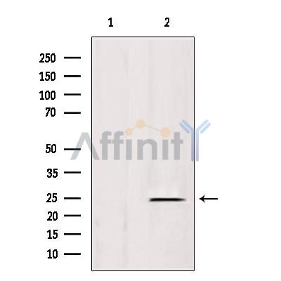 IFT25 Antibody - Western blot analysis of extracts from rat spleen, using IFT25 antibody.
