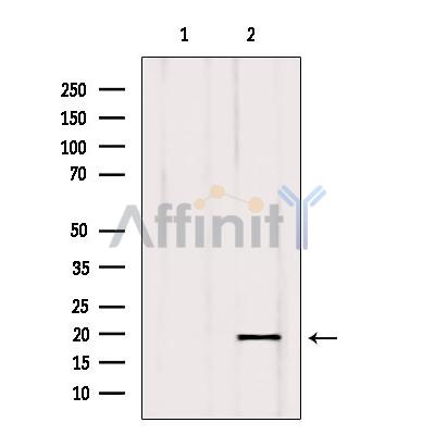 ISCU Antibody - Western blot analysis of extracts from rat spleen, using ISCU antibody.