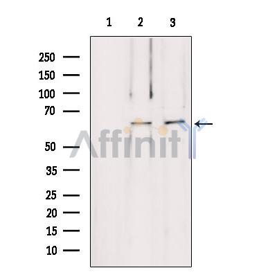 LMOD1 Antibody - Western blot analysis of extracts from various samples, using LMOD1 antibody.