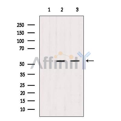 TRIM44 Antibody - Western blot analysis of extracts from various samples, using TRIM44 antibody.