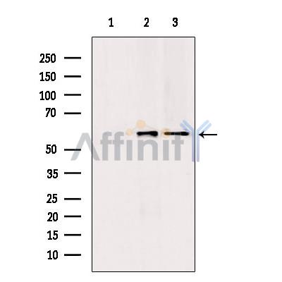 PKLR Antibody - Western blot analysis of extracts from various samples, using PKLR antibody.