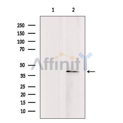 TMOD4 Antibody - Western blot analysis of extracts from rat brain, using TMOD4 antibody.