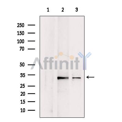 CHMP4B Antibody - Western blot analysis of extracts from various samples, using CHMP4B antibody.