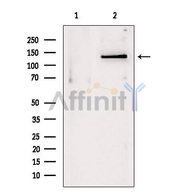 DHX9 Antibody - Western blot analysis of extracts from Mouse myeloma, using DHX9 antibody.