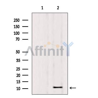 Osteocalcin Antibody - Western blot analysis of extracts from rat brain, using Osteocalcin antibody.