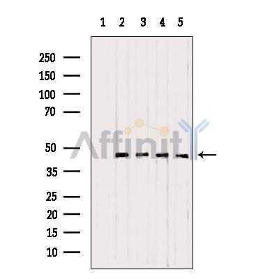 UQCRC1 Antibody - Western blot analysis of extracts from various samples, using UQCRC1 antibody.