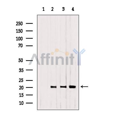 CNPY2/MSAP Antibody - Western blot analysis of extracts from 293,B16F10,Mouse myeloma, using CNPY2,MSAP antibody.